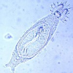 Гиродактилез (Gyrodactylus). Симптомы. Лечение Гиродактилез (Gyrodactylus). Симптомы. Лечение